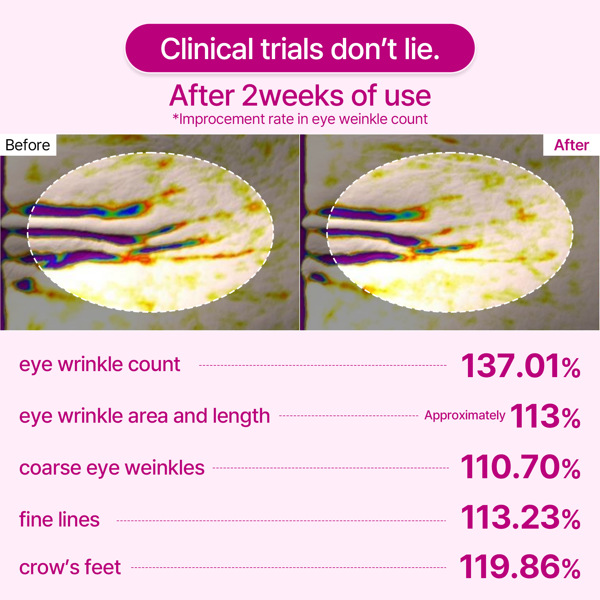 Cemenrete Calcium Volume Eye patch 60ea