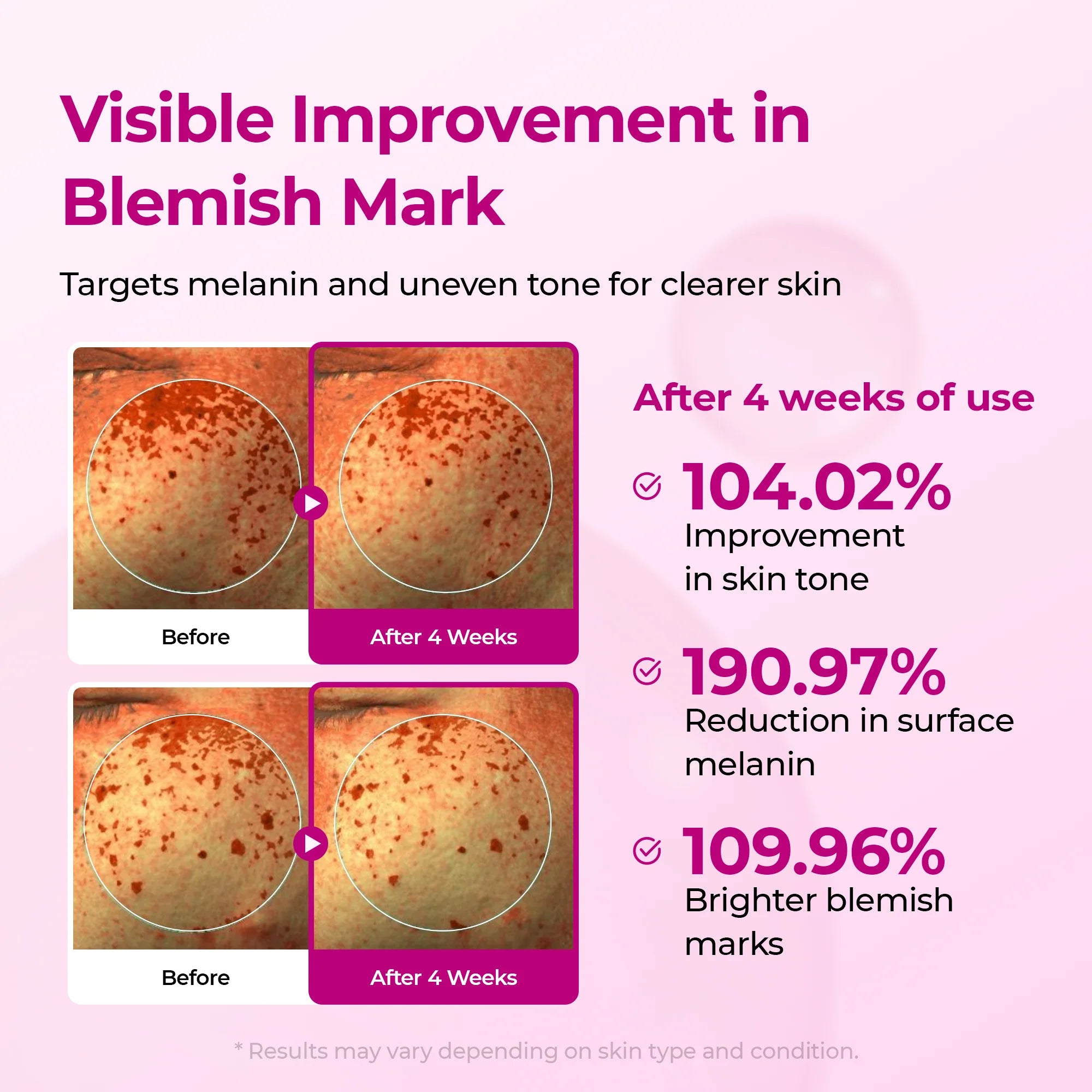 Picotonic Shot Pigmentation Ampoule