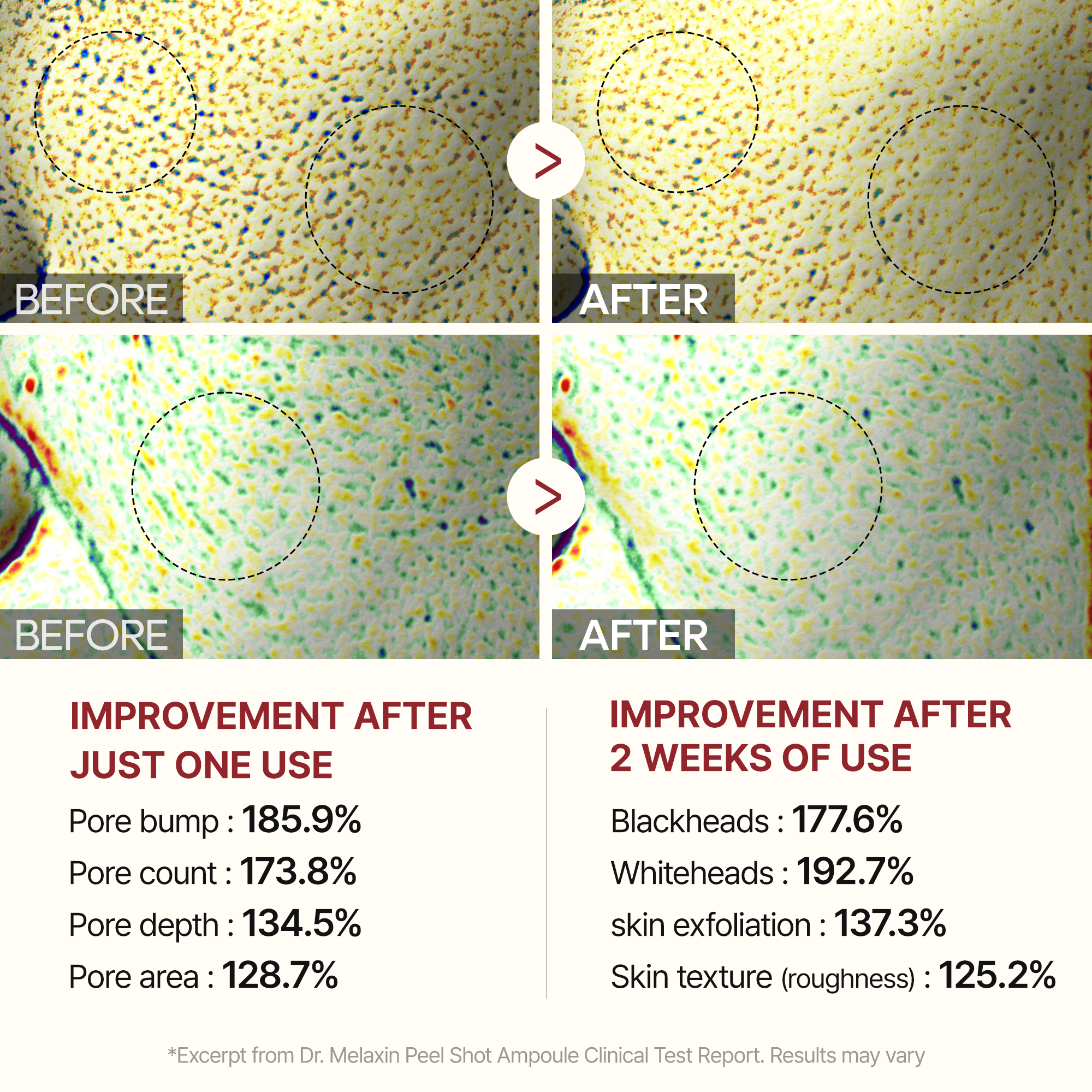 Peel Shot Glow White Rice Ampoule